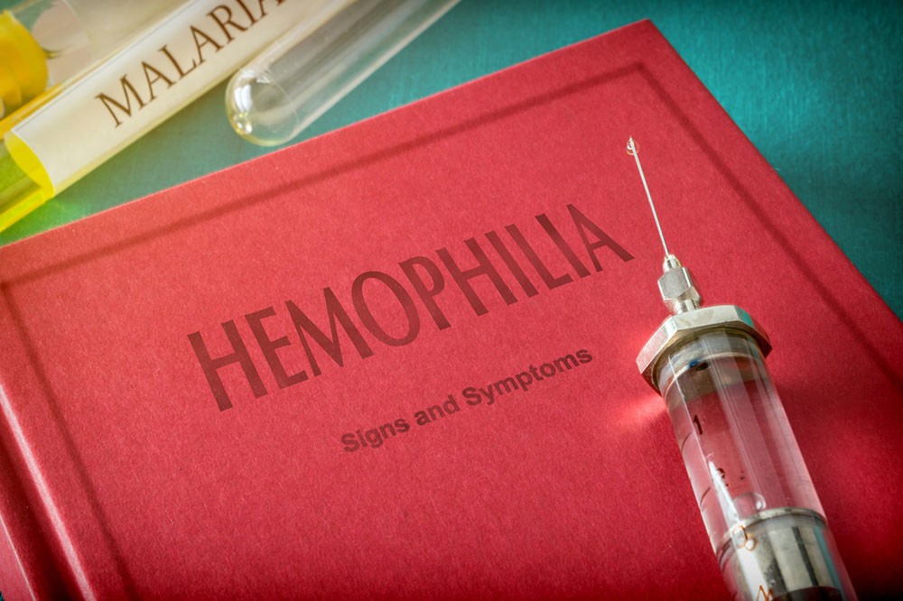8 Natural Remedies to Manage Hemophilia