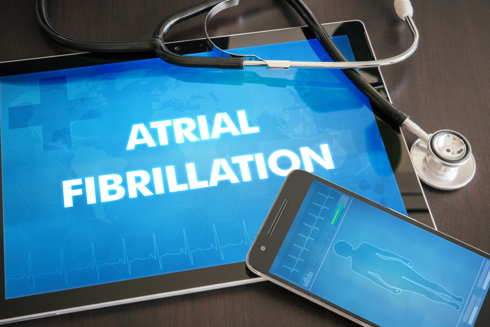 9 Treatments to Manage Atrial Fibrillation